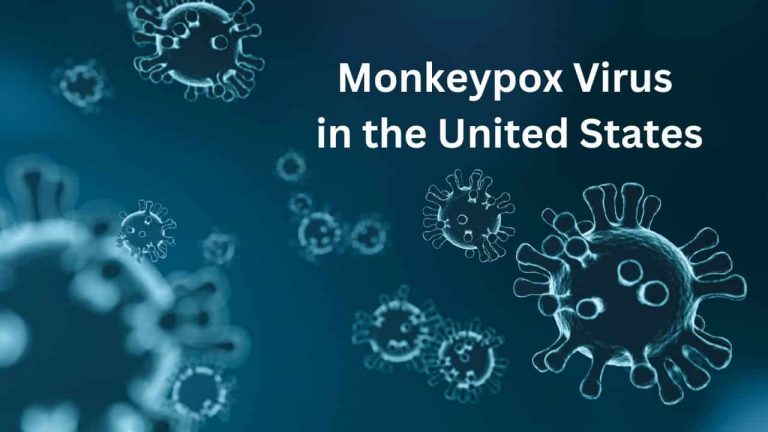 Monkeypox Virus in the United States
